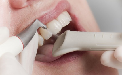 10 Tipuri moderne de beneficii și rău pentru albirea dinților