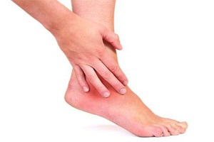 Artrita articulațiilor piciorului - cauze, simptome și tratament al artritei piciorului, articole despre