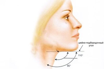 Facelift non-chirurgical (lifting non-operative) - ceea ce este, fire, recenzii, preturi, fotografii