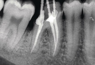 Endodonția din Moscova