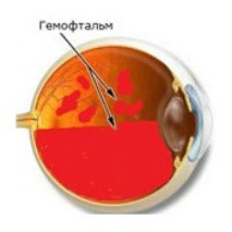 Simptomele hematologice, diagnosticul și tratamentul