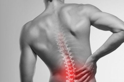 Hernia coloanei vertebrale, simptomele și indicațiile sale pentru intervenția chirurgicală
