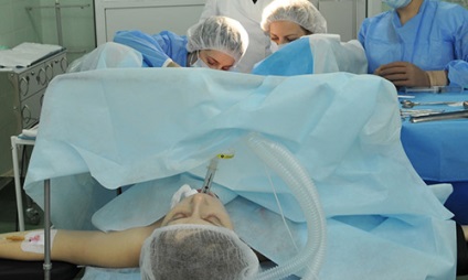 Material plastic intim - care ar trebui să efectueze operația unui ginecolog sau chirurg plastic