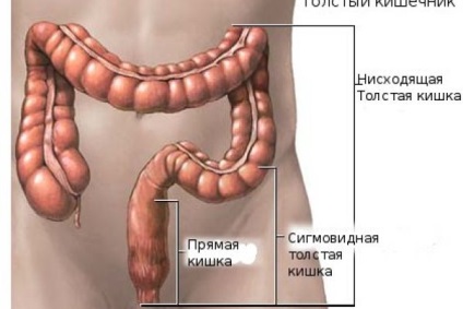 Cum se vindeca colita la domiciliu - colita cronica a intestinului cum se trateaza tratamentul in