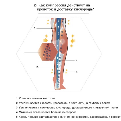 Ciorne de compresie din valoare varicoasă, recenzii, alese de producător