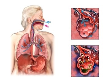 Croup pneumonie la copii simptome, tratament, prevenire, cauzele bolii