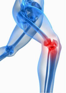 Tratamentul artritei, bursitei, osteoartritei și a altor boli articulare