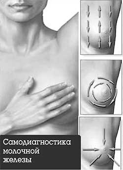 Lobularis mell, dyshormonal lokalizált, leépülési és mirigyek breast