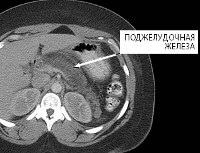 Mirt pancreas - preturi in moscow, gasit 75 preturi