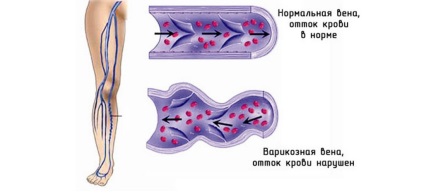 Încălcarea vărsăturilor - cauze, simptome, diagnostic și tratament