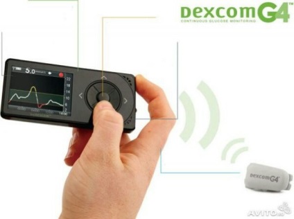 Folyamatos ellenőrzése vércukor dexcom g4 platina