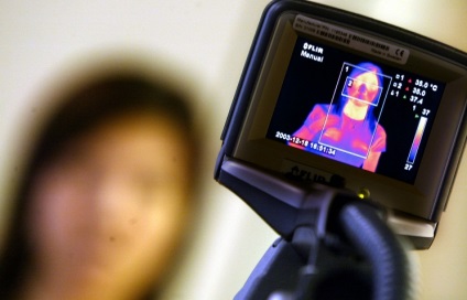 Oamenii de știință din Novosibirsk au dezvoltat un imager termic pentru diagnosticarea bolilor - Patrioții din Rusia