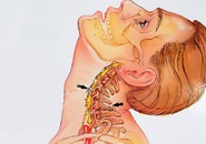 Fractura coloanei vertebrale cervicale, simptome, diagnostic și tratament