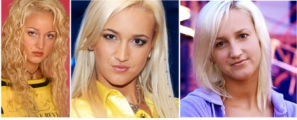 Chirurg plastic a dezvăluit secretele - o nouă față - Olga Buzovy - esența evenimentelor