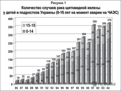 Prezentarea pe tema tratamentului glandei tiroide a tumorilor cu autorii iodului radioactiv Kononova, boiarsky