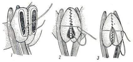 Rănile abdominale penetrante (vulnera abdominis reforata) 1958 - Bolile câinilor (non-contagioase)