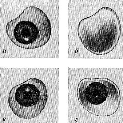 Ochiul protetic