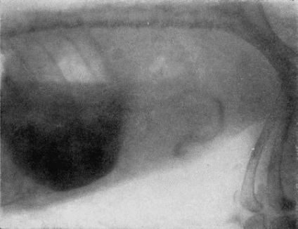 X-ray vizsgálatokat kontrasztanyagok