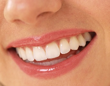 Replantarea dinților - indicații și contraindicații