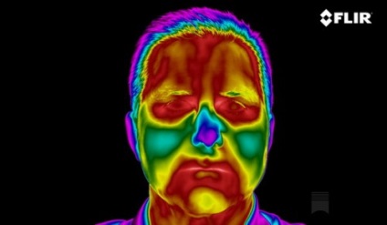 Importanța aplicării imaginilor termice în domeniul medicinii