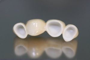 Dinți din dioxid de aluminiu