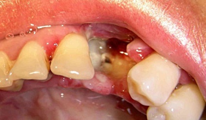 Dentiții prin numere în stomatologie - fotografie și descriere