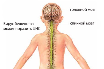 Бяс при деца - симптоми, лечение и профилактика на бяс при деца, предизвиква на заболяване