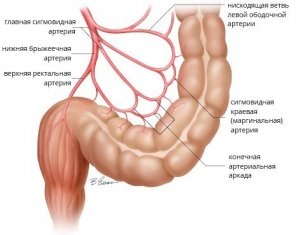 Durerea în colonul sigmoid ca manifestare a sigmoiditei