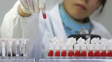 Medicii britanici sunt pe punctul de a descoperi un medicament pentru HIV