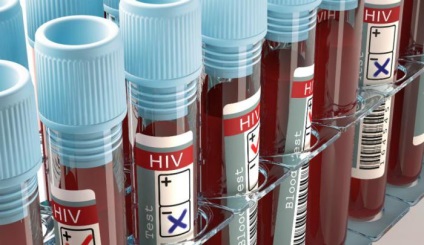 Medicii britanici sunt pe punctul de a descoperi un medicament pentru HIV