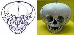 Deformarea și trepanarea craniului este un obicei ciudat