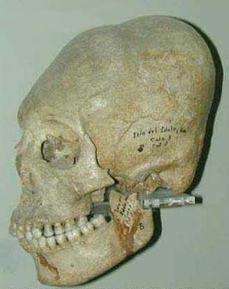 Deformarea și trepanarea craniului este un obicei ciudat