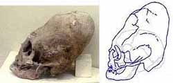 Deformáció és craniotomy - egy különös szokás