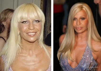 Donatella Versace fotografie înainte și după operație - 300