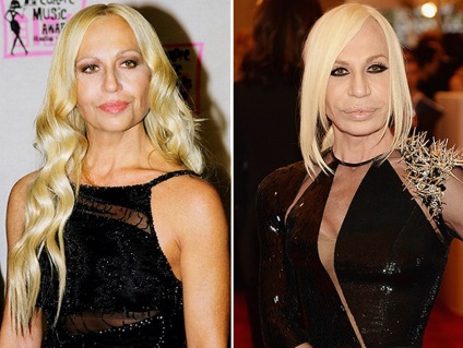 Donatella Versace fotografie înainte și după operație - 300