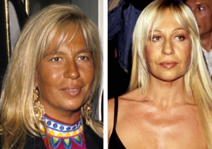 Donatella Versace fotografie înainte și după operație - 300