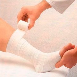 Cum să tratezi asteriscuri vasculare pe picioarele tale, descrieri ale diferitelor tratamente