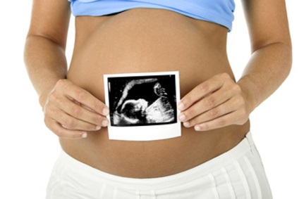 Hogyan készüljünk fel a terhességi ultrahang