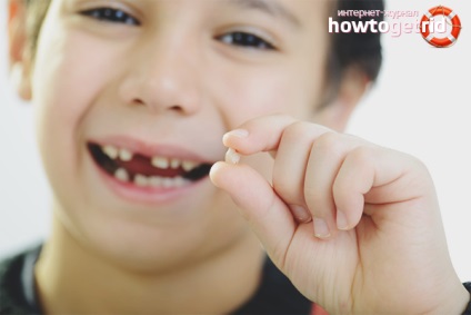 Hogyan húzza ki a fogat gyermek otthon