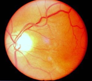 Vérellátása retina