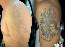 Laser Tattoo Removal - studio de tatuaj alb de șoim