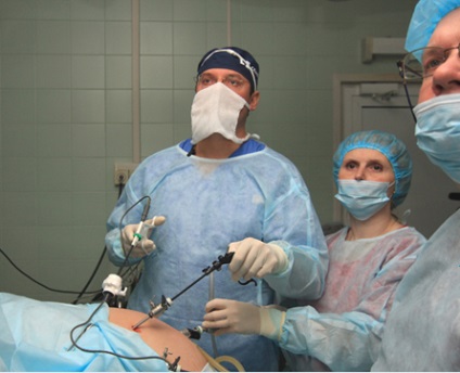 Tratamentul herniei esofagului - tratamentul laparoscopic al herniilor diafragmatice și sporulării
