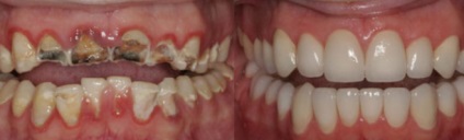 Tratamentul și protezele dinților din China
