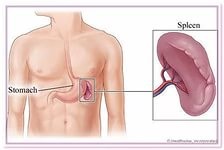 Tratamentul splinei cu remedii folclorice, medicina populară