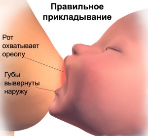 Mastitis szoptatós anyák tünetei és kezelése