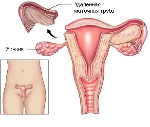 Medvedev - Obstetrician-ginecolog de cea mai înaltă categorie