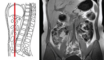 MMR tomografie canalului de cavitate abdominală, avicena 1