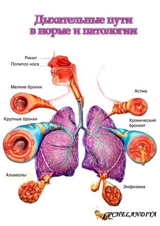 Tratamentul tradițional al astmului bronșic