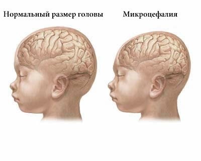 O mică anatomie