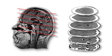 Clinica neurochirurgicală din München, Germania